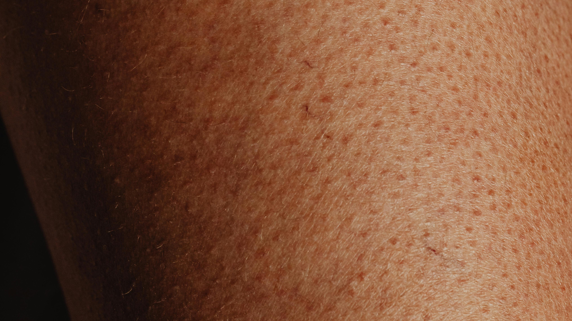 skin